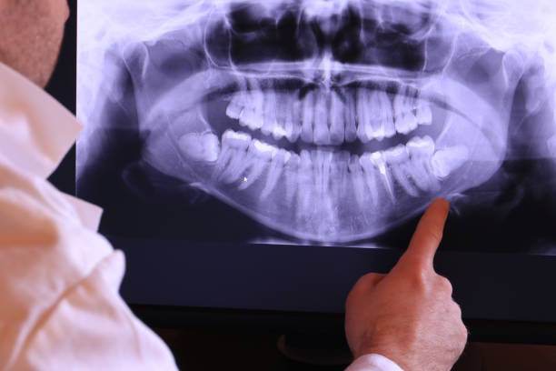 Best Walk-In Emergency Dentist in Columbia, SC