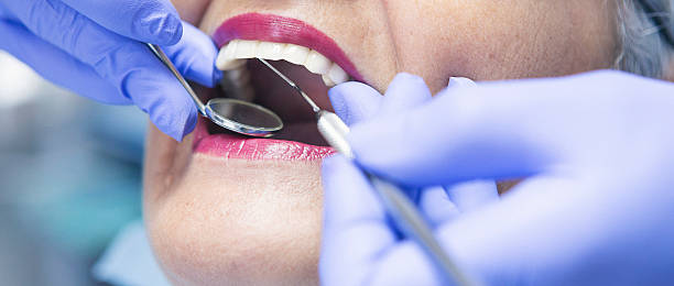 Best Emergency Treatment for Toothache in Columbia, SC